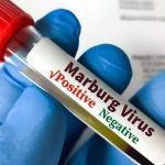 Rwanda : La propagation du virus de Marburg « sous contrôle »